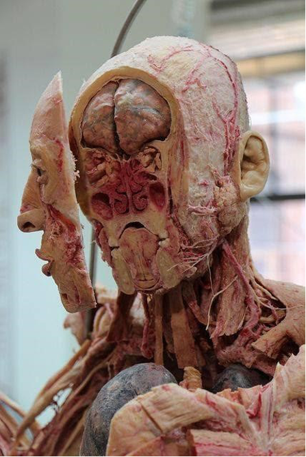 Cadaver image