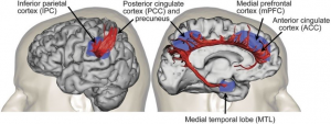 brain detail image